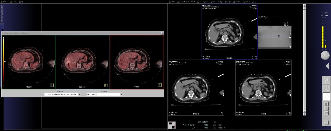 prototype of PET Classic Interventional Fusion Display